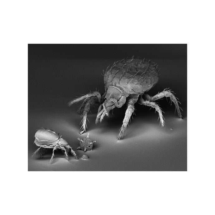 Dust Mites and Pollen under an Electron Microscope - Giclée - Print